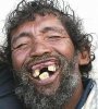 bum_with_bad_teeth.jpg