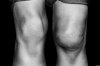 knees.jpg